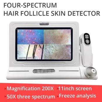 Детектор кожи головы HD, парикмахерская, волосяной фолликул, волосяной инструмент, детектор и анализ кожи с экраном