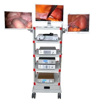 1080P Эндоскопическая система для эндоскопической хирургии ЛОР-гистероскопии